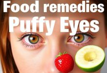 با این خوراکی ها پف چشم را چطور از بین ببریم؟