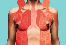 اختلالات خوردن چیست و علائم آن کدامند