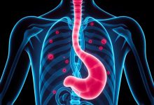 خوراکی خوشمزه: تهدید سرطان مری و معده؟