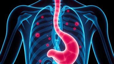 خوراکی خوشمزه: تهدید سرطان مری و معده؟